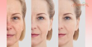 How Facial Rejuvenation Procedures Can Enhance Aging Skin